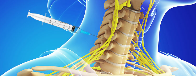 patient receiving Cervical Epidural Steroid Injections in Coppell for auto accident injury pain relief