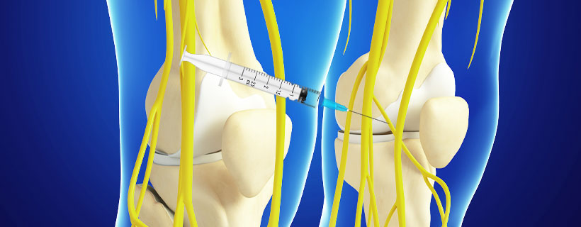 patient receiving Genicular Nerve Block in Coppell for auto accident injury pain relief