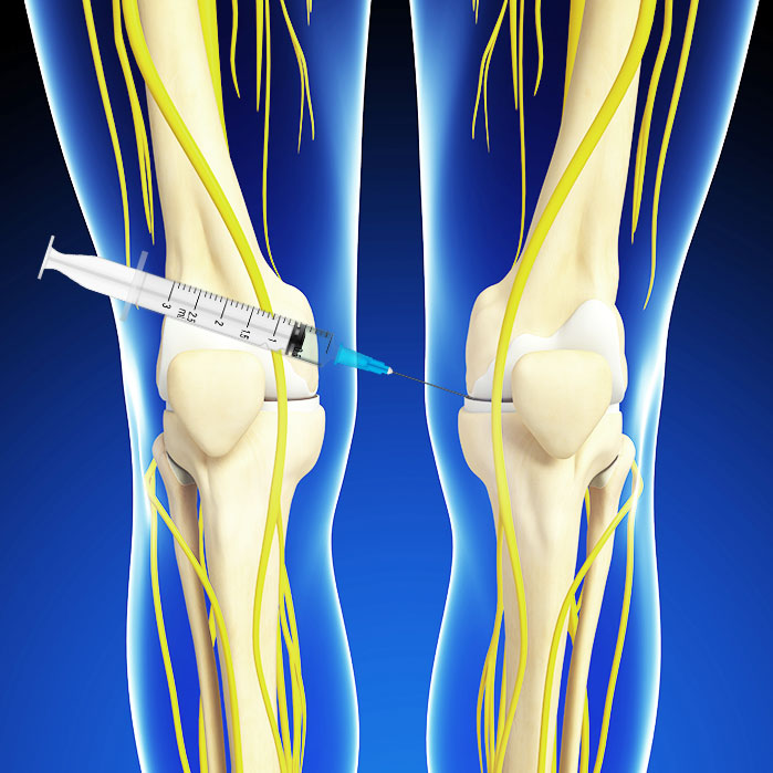 hyalgan knee injections in Coppell