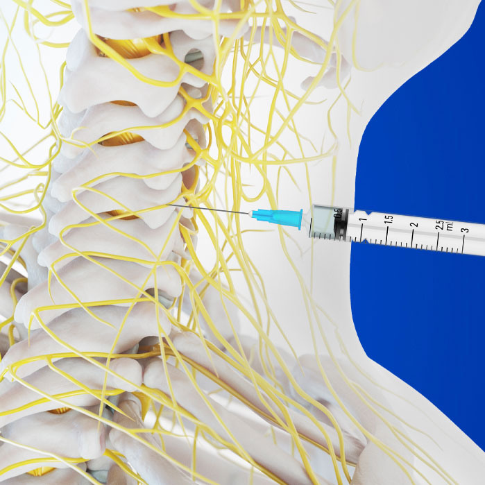 medial branch block in Coppell