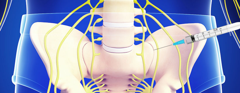 patient receiving Sacroiliac Joint Steroid Injections in Coppell for auto accident injury pain relief